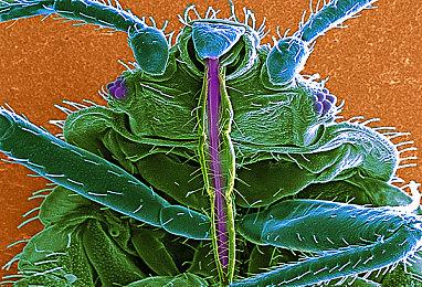 《上古卷轴》资深配音演员脱离生命危险 致谢众筹粉丝